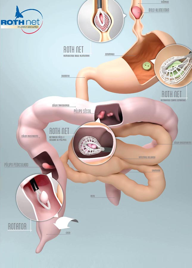 Endoscopia
